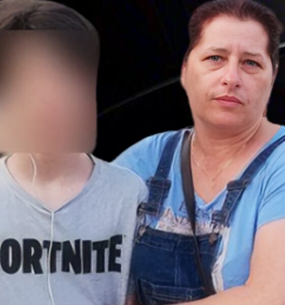Femeie arsă